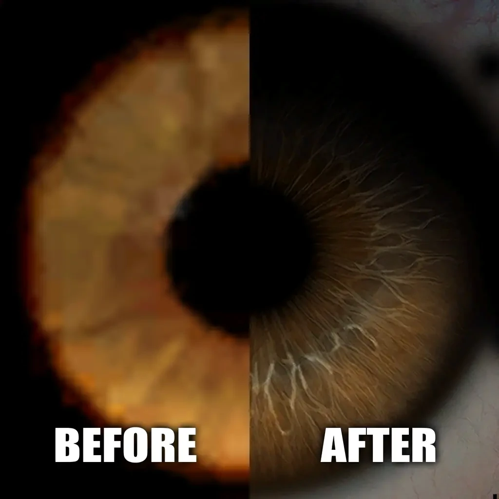 Close-up comparison of character eye textures before and after improvement in Vampire The Masquerade Bloodlines mod